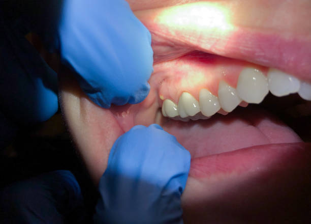 Best Emergency Dentist Near Me  in Byesville, OH