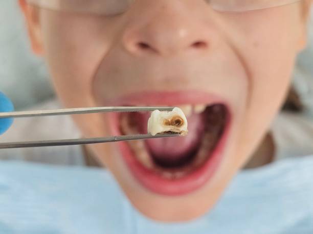 Best Tooth Pain Emergency Relief  in Byesville, OH